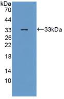 Polyclonal Antibody to Estrogen Receptor Alpha (ERa)