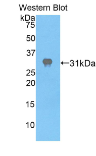 Polyclonal Antibody to Apoptotic Peptidase Activating Factor 1 (APAF1)