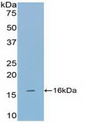 Polyclonal Antibody to Tryptase (TPS)