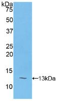 Polyclonal Antibody to Polymeric Immunoglobulin Receptor (PIGR)