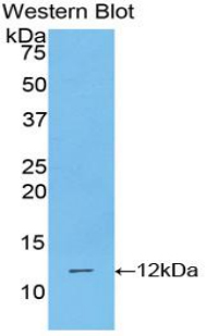 Polyclonal Antibody to Polymeric Immunoglobulin Receptor (PIGR)