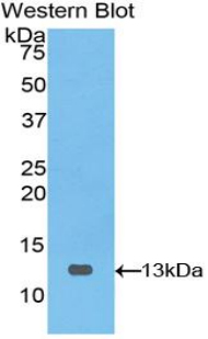 Polyclonal Antibody to Polymeric Immunoglobulin Receptor (PIGR)