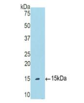 Polyclonal Antibody to Polymeric Immunoglobulin Receptor (PIGR)