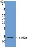 Polyclonal Antibody to Polymeric Immunoglobulin Receptor (PIGR)