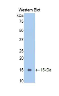 Polyclonal Antibody to Polymeric Immunoglobulin Receptor (PIGR)