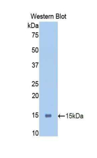 Polyclonal Antibody to Polymeric Immunoglobulin Receptor (PIGR)