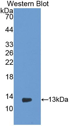 Polyclonal Antibody to Polymeric Immunoglobulin Receptor (PIGR)