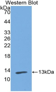 Polyclonal Antibody to Polymeric Immunoglobulin Receptor (PIGR)