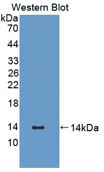 Polyclonal Antibody to S100 Calcium Binding Protein A12 (S100A12)
