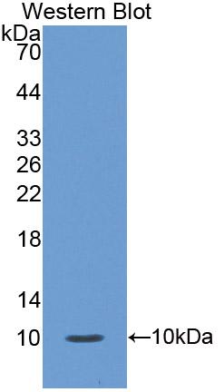 Polyclonal Antibody to S100 Calcium Binding Protein A12 (S100A12)