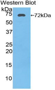 Polyclonal Antibody to Heat Shock 70kDa Protein 1A (HSPA1A)