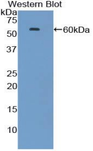 Polyclonal Antibody to Heat Shock 70kDa Protein 1A (HSPA1A)