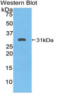Polyclonal Antibody to Heat Shock 70kDa Protein 9 (HSPA9)