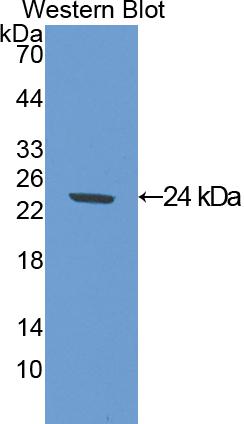 Polyclonal Antibody to Superoxide Dismutase 2, Mitochondrial (SOD2)