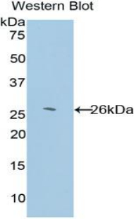 Polyclonal Antibody to Glutathione S Transferase Kappa 1 (GSTk1)