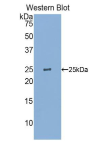 Polyclonal Antibody to Glutathione S Transferase Pi (GSTp)