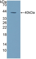 Polyclonal Antibody to Alkaline Phosphatase, Tissue-nonspecific (ALPL)