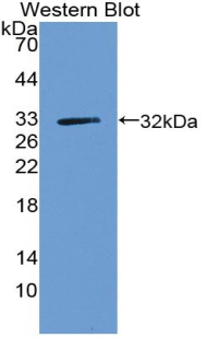 Polyclonal Antibody to Brain Finger Protein (BFP)