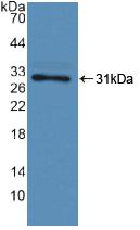 Polyclonal Antibody to Coagulation Factor XIII A1 Polypeptide (F13A1)