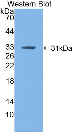 Polyclonal Antibody to Coagulation Factor XIII A1 Polypeptide (F13A1)