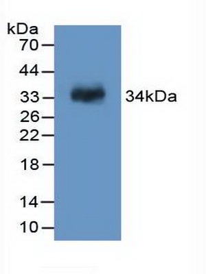 Polyclonal Antibody to Coagulation Factor XIII A1 Polypeptide (F13A1)