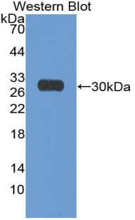 Polyclonal Antibody to Nuclear Matrix Protein 4 (NMP4)