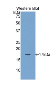 Polyclonal Antibody to Myosin Light Chain 1 (MYL1)