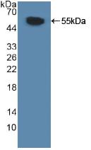 Polyclonal Antibody to Myosin Light Chain Kinase (MYLK)