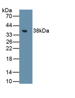 Polyclonal Antibody to Metallothionein 1 (MT1)