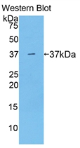 Polyclonal Antibody to Arginase (ARG)