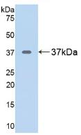 Polyclonal Antibody to Arginase (ARG)