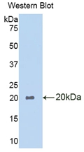 Polyclonal Antibody to Phospholipase A1 (PLA1)