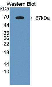 Polyclonal Antibody to Fibrinogen Alpha Chain (FGA)