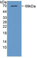 Polyclonal Antibody to Thioredoxin-interacting Protein (TXNIP)