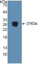 Polyclonal Antibody to Dynamin 2 (DNM2)