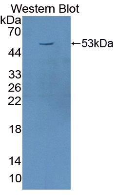 Polyclonal Antibody to Transferrin Receptor (TFR)