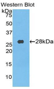 Polyclonal Antibody to Transferrin Receptor (TFR)