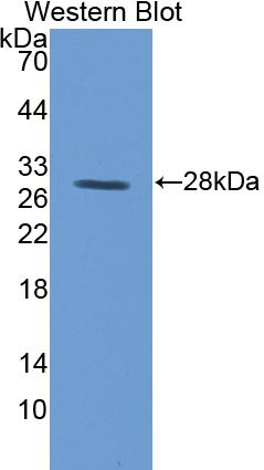 Polyclonal Antibody to Transferrin Receptor (TFR)