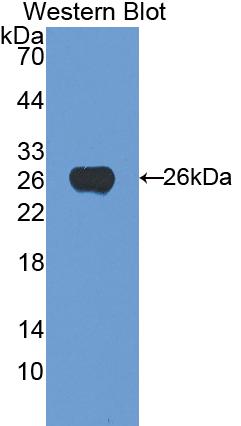 Polyclonal Antibody to Transferrin Receptor (TFR)