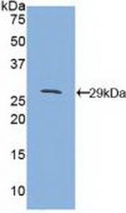 Polyclonal Antibody to Cluster Of Differentiation 1d (CD1d)