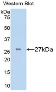 Polyclonal Antibody to Clusterin (CLU)