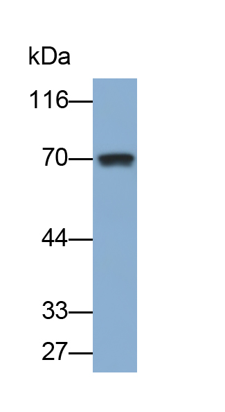 Polyclonal Antibody to Taxilin Alpha (TXLNa)