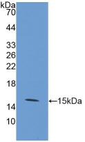 Polyclonal Antibody to Glucose Transporter 1 (GLUT1)