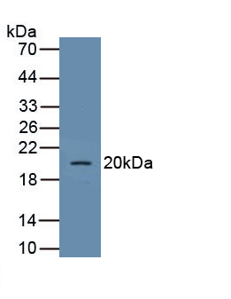 Polyclonal Antibody to Glucose Transporter 1 (GLUT1)