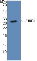 Polyclonal Antibody to Asialoglycoprotein Receptor 1 (ASGR1)