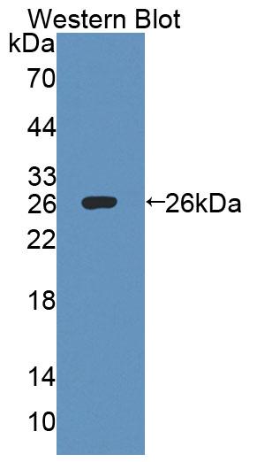 Polyclonal Antibody to Interleukin 27 Receptor Alpha (IL27Ra)