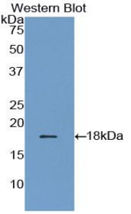 Polyclonal Antibody to Glia Maturation Factor Gamma (GMFg)