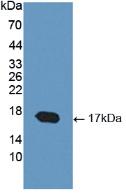 Polyclonal Antibody to Cartilage Oligomeric Matrix Protein (COMP)