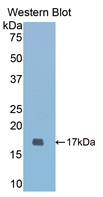 Polyclonal Antibody to Cartilage Oligomeric Matrix Protein (COMP)