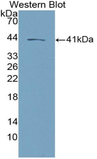 Polyclonal Antibody to Neurokinin B (NKB)